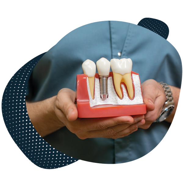 What Makes Dental Implants in Turkey So Popular?